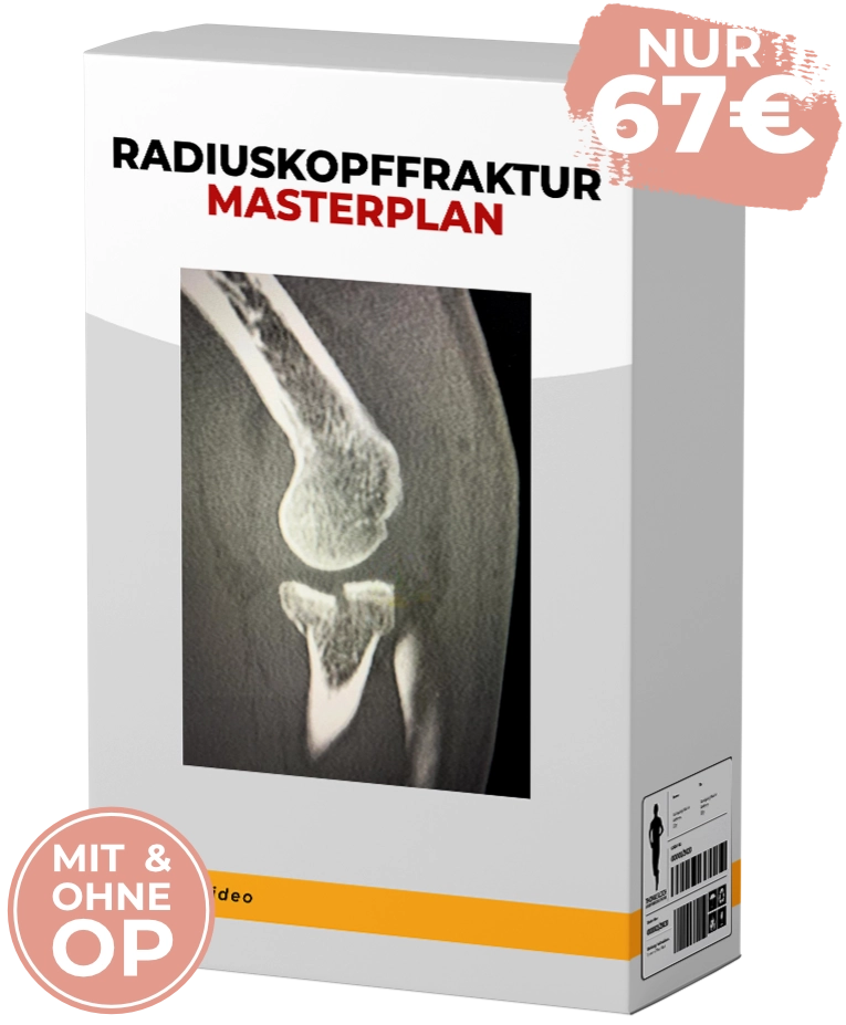 Radiuskopf Masterplan Produkt